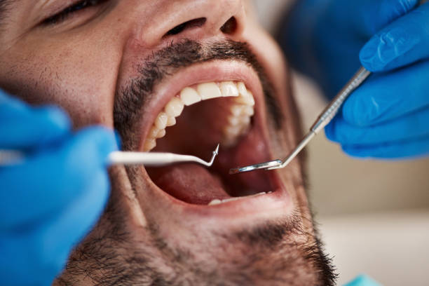 Best Emergency Treatment for Oral Infections in Lehighton, PA